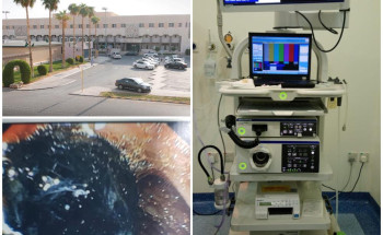 إنهاء معاناة مريضة من إنسداد في القناة الصفراوية