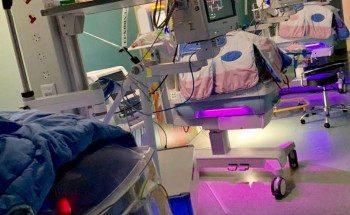 عملية ناجحة بالدماغ لطفلة عمرها 15 يوماً في مستشفى النساء والولادة بالجوف