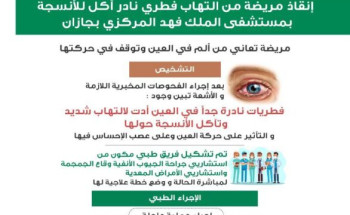 مستشفى الملك فهد المركزي بجازان يُنهي معاناة  مريضة من التهاب فطري نادر آكل للأنسجة