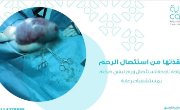 استئصال ورمين ليفيين كبيرين من مريضة خمسينية دون استئصال الرحم بـ “رعاية الرياض”