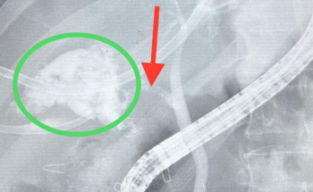 عملية منظار ناحجة لحاج في “قافلة الصحة”