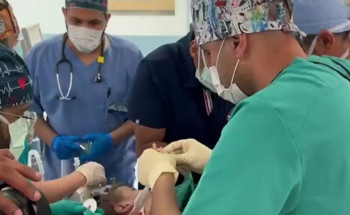 تنفيذًا لتوجيهات القيادة.. بدء عملية فصل التوأم السيامي السوري “إحسان وبسام”