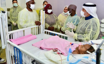 استقرار الحالة الصحية للتوأم السيامي النيجيري “حسنة وحسينة” بعد 48 ساعة من فصلهما