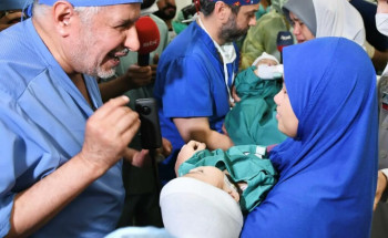 نجاح فصل التوأم السيامي الفلبيني “أكيزا وعائشة” بعد عملية جراحية دقيقة استغرقت خمس ساعات