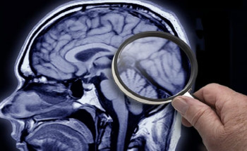 تظهر قبل 11 عامًا.. احذر من علامتين قد تكشفان خطر الإصابة بالخرف