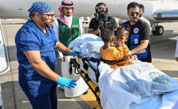 إنفاذًا لتوجيهات خادم الحرمين الشريفين وسمو ولي العهد.. وصول التوأم الملتصق الجامايكي “أزاريا وأزورا إيلسون” إلى الرياض لدراسة حالتهما الطبية
