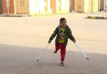 تصريح مروع عن غزة.. مفوض الأونروا: 10 أطفال يفقدون ساقاً أو ساقين يومياً