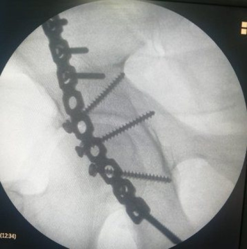 تدخل طبي ناجح في مستشفى القويعية مع حالة مصاب في حادث مروري