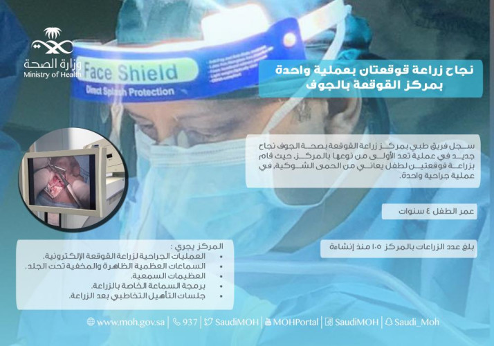 نجاح زراعة قوقعتان عبر عملية واحدة بمركز القوقعة بالجوف