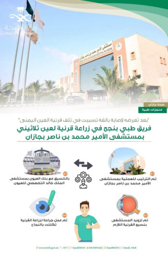 مستشفى الأمير محمد بن ناصر  بجازان ينجح في زراعة قرنية لعين لمريض  