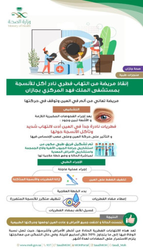 مستشفى الملك فهد المركزي بجازان يُنهي معاناة  مريضة من التهاب فطري نادر آكل للأنسجة