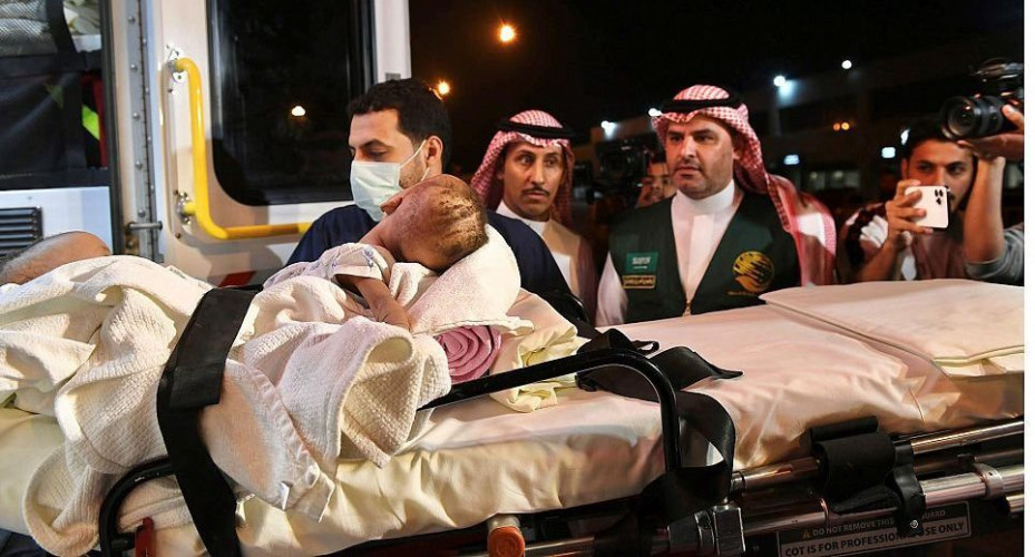 إنفاذًا لتوجيهات خادم الحرمين الشريفين .. وصول التوأم السيامي النيجيري “حسانة وحسينة” إلى الرياض