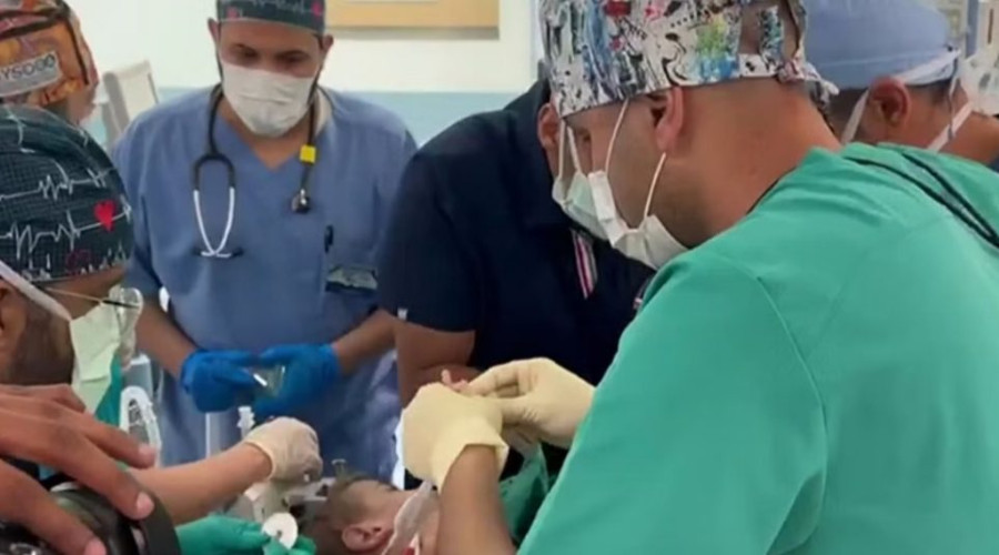 تنفيذًا لتوجيهات القيادة.. بدء عملية فصل التوأم السيامي السوري “إحسان وبسام”