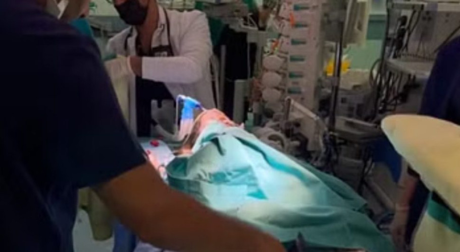 انتهاء عملية فصل السيامي السوري “بسام وإحسان”