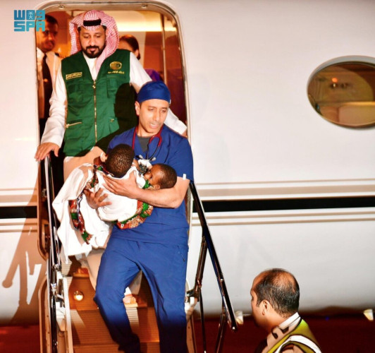 إنفاذًا لتوجيهات خادم الحرمين الشريفين ولي العهد.. وصول التوأم السيامي التنزاني “حسن وحسين” إلى الرياض