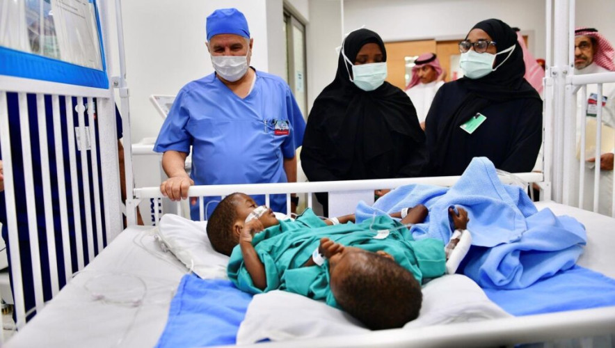 بدء عملية فصل التوأم السيامي التنزاني “حسن وحسين”