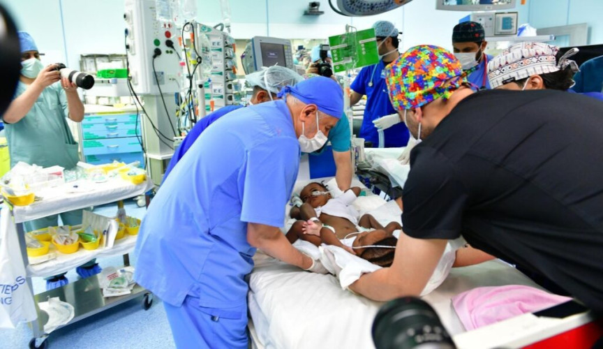 إنفاذًا لتوجيهات القيادة الرشيدة.. بدء عملية فصل التوأم السيامي النيجيري “حسنة وحسينة”