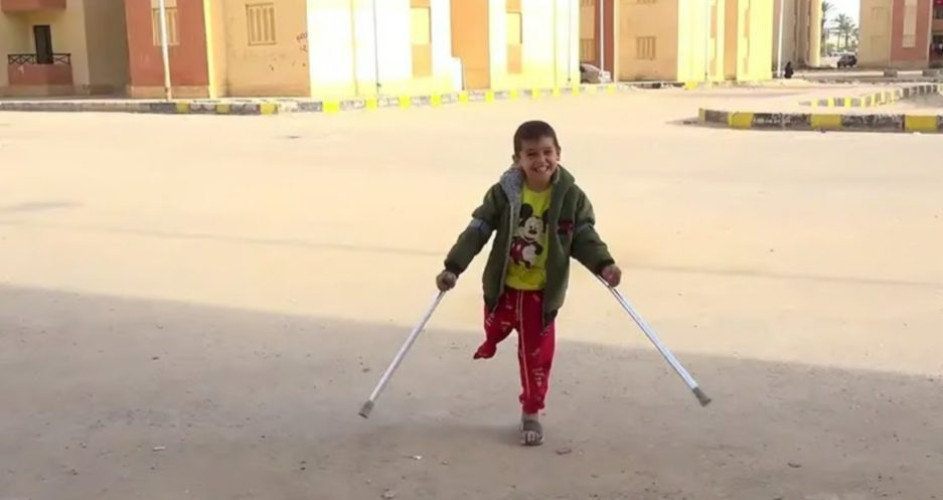 تصريح مروع عن غزة.. مفوض الأونروا: 10 أطفال يفقدون ساقاً أو ساقين يومياً