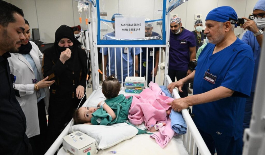 إنفاذًا لتوجيهات خادم الحرمين الشريفين وسمو ولي العهد.. بدء عملية فصل التوأم المُلتصق السوري “سيلين وإيلين”