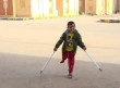 تصريح مروع عن غزة.. مفوض الأونروا: 10 أطفال يفقدون ساقاً أو ساقين يومياً