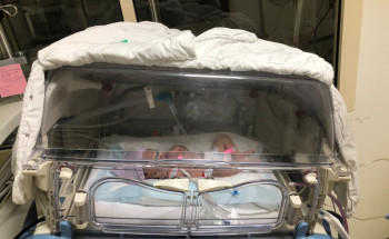 ولادة ناجحة لمريضة على رئة اصطناعية لمصابة كورونا بمستشفى أحد بصحة المدينة المنورة