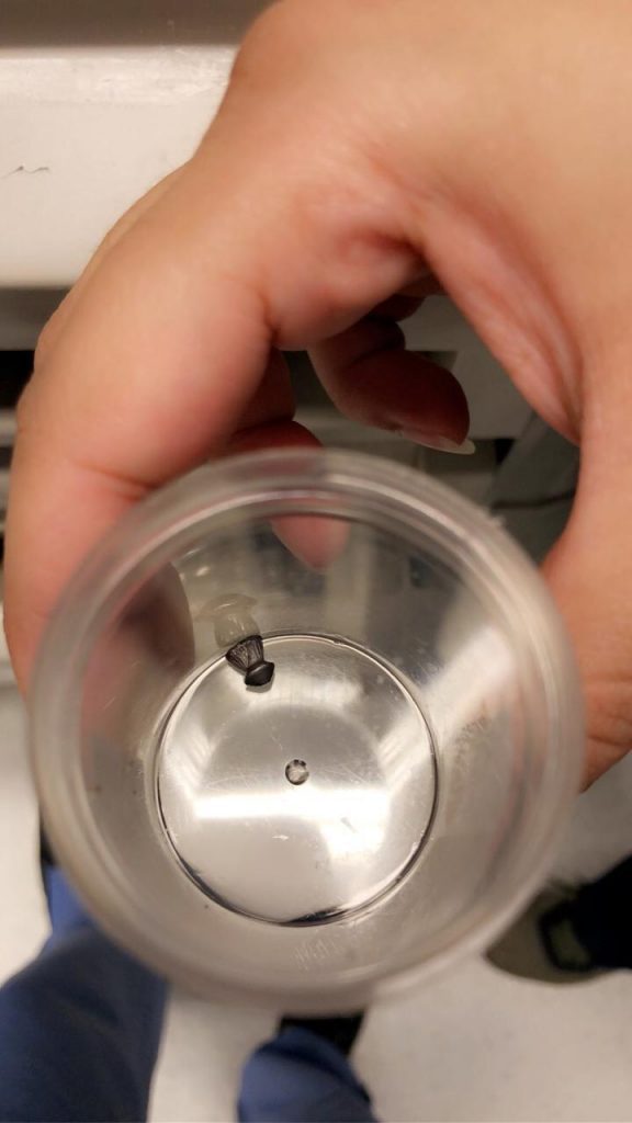 تدخل طبي ناجح مع حالة مصاب في قاع الجمجمة تدخل طبي ناجح مع حالة مصاب في قاع الجمجمة