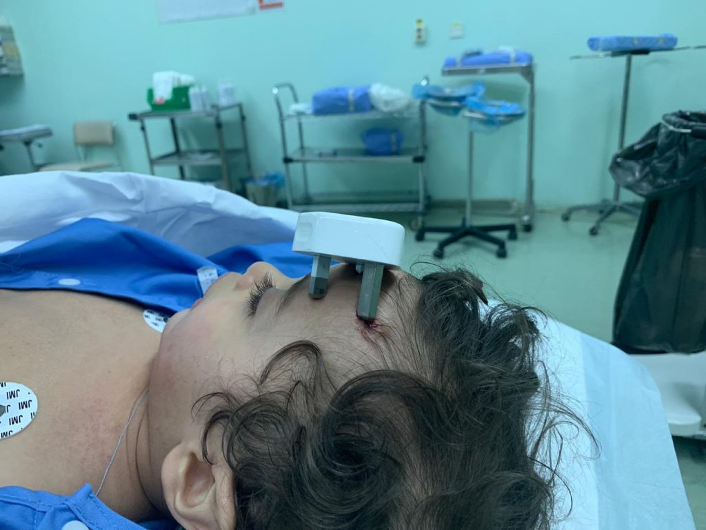 عملية عاجلة لإنقاذ طفل إخترق رأسه شاحن جوال عملية عاجلة لإنقاذ طفل إخترق رأسه شاحن جوال